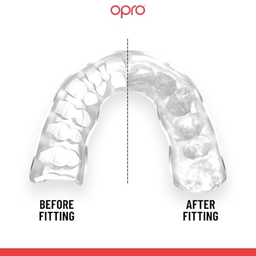 OPRO Official UFC Fighter Collection Tom Aspinall Instant Custom-Fit Mouthguard – Self-Fit Gum Shield for MMA, Boxing & Combat Sports - color: Tom Aspinall