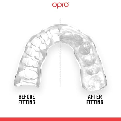OPRO Official UFC Fighter Collection Tom Aspinall Instant Custom-Fit Mouthguard – Self-Fit Gum Shield for MMA, Boxing & Combat Sports - color: Tom Aspinall