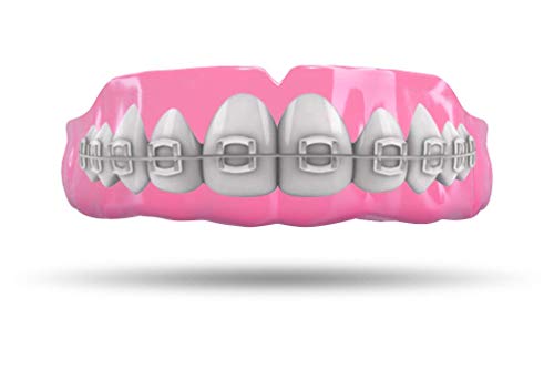 Impact Custom Professional MMA/Boxing/Muay Thai Mouthguard with Trim for Gag Reflex - color: Braces