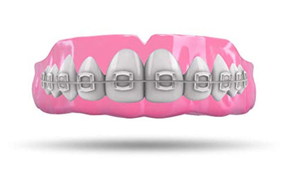 Impact Custom Professional MMA/Boxing/Muay Thai Mouthguard with Trim for Gag Reflex - color: Braces