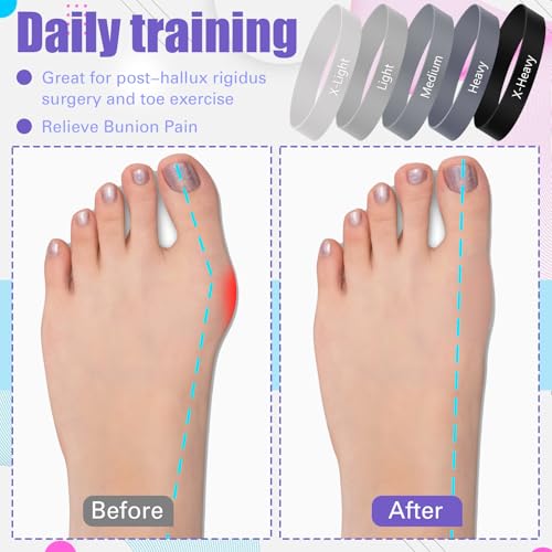 WinnerWhy 5 Pack Toe Exercise Bands Stretcher Separator Spacer,Grey - color: Grey