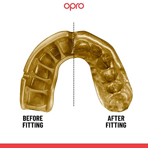 OPRO Gold Level Moldable Mouth Guard with Strap Premium Fit Adult & Kids Boxing Mouthguard for Football & Impact Sports, Self-Fit Mouth Guard for Sports, MMA & Hockey - Includes Case