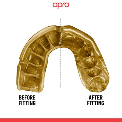 OPRO Gold Level Moldable Mouth Guard with Strap Premium Fit Adult & Kids Boxing Mouthguard for Football & Impact Sports, Self-Fit Mouth Guard for Sports, MMA & Hockey - Includes Case