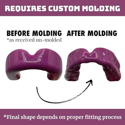 Zero-G Adult Mouthguard Purple 1-Pack, Boil & Bite for Contact Sports - color: Purple