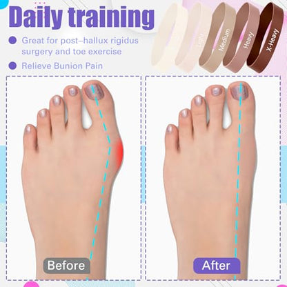 WinnerWhy 5 Pack Toe Exercise Bands Stretcher Separator Spacer,Coffee - color: Coffee