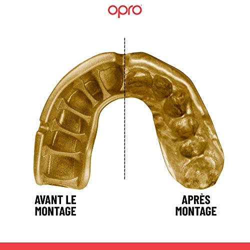 OPRO Youth Instant Custom Fit Moldable Mouth Guard, Dentist Level - color: Dark Blue/Gold, size: Youth (Under 10)