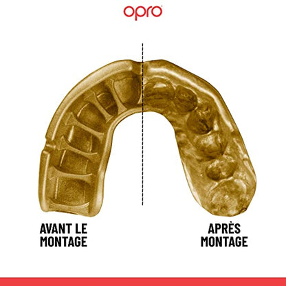 OPRO Youth Instant Custom Fit Moldable Mouth Guard, Dentist Level - color: Dark Blue/Gold, size: Youth (Under 10)