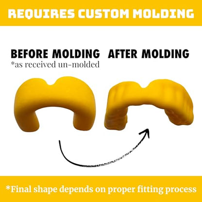 Zero-G Adult Mouthguard Yellow 1-Pack, Boil & Bite for Contact Sports - color: Yellow