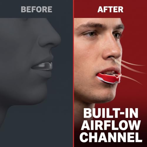 Red Mouth Guard, Sports Mouth Guard Mouthguard for Football, Basketball, Hockey, MMA, Boxing, Jiu Jitsu, Adult & Youth Red&White Adults Mouthguards