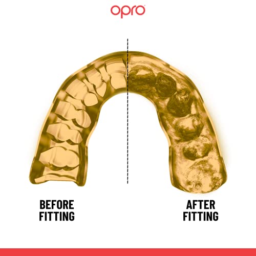 OPRO Instant Custom-Fit Mouthguard – Dentist Level Gum Shield Adult and Kids – OPRO Mouth Guard Boxing and MMA, Self-Fit Gum Shield Rugby – Maximum Protection with Dental Warranty (Black/White/Silver) - color: Usa Flag, size: Adult (10+)