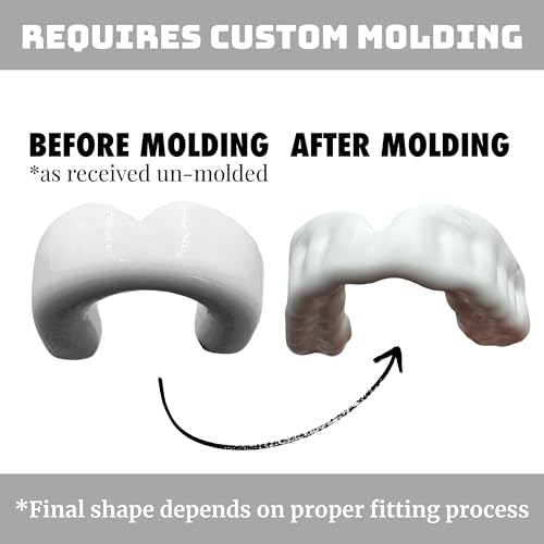 Zero-G Adult Mouthguard White 1-Pack, Boil & Bite for Contact Sports - color: White