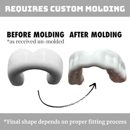 Zero-G Adult Mouthguard White 1-Pack, Boil & Bite for Contact Sports - color: White
