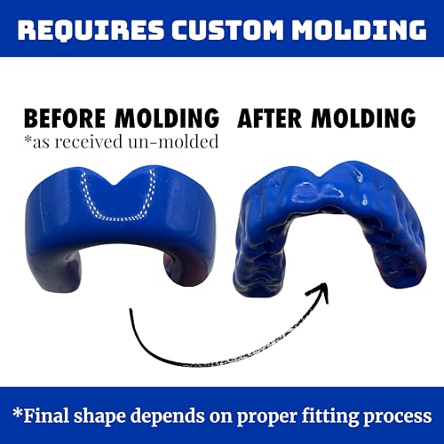 Zero-G Adult Mouthguard Blue 1-Pack, Boil & Bite for Contact Sports - color: Blue