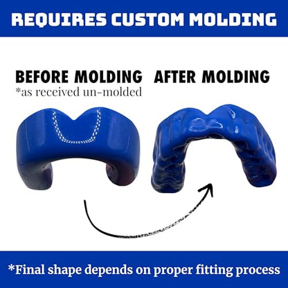 Zero-G Adult Mouthguard Blue 1-Pack, Boil & Bite for Contact Sports - color: Blue