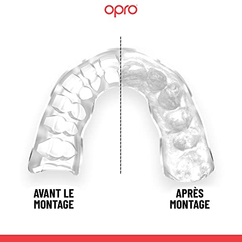 OPRO Instant Custom Fit Moldable Mouth Guard, Dentist Level, Adults & Kids - color: Black Jaws - Black/White/White, size: Adult (10+)
