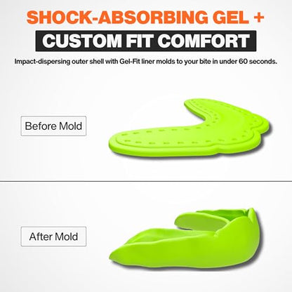 Shock Doctor MicroGel Sports Mouth Guard, Football, Basketball, Boxing, Lacrosse Mouthguard - color: Kool-aid