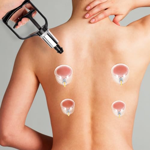 NOLITOY Universal Cupping Vacuum Pump - High Suction Manual Hand Pump Replacement - One-Hand Operation Portable Vacuum Handle for Chinese Cupping Therapy, Home Spa & Massage Parlor