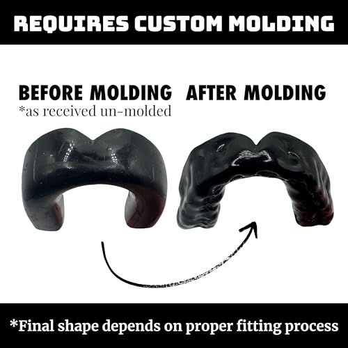 Zero-G Adult Mouthguard Black 1-Pack, Boil & Bite for Contact Sports - color: Black