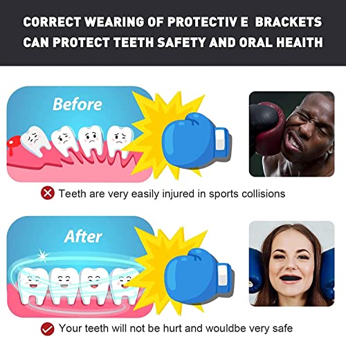3 Pack Kids Youth Mouth Guard Football Sports Braces Mouthguards for Mouthpiece Boys Teeth for MMA Boxing Rugby Kickboxing Taekwondo Softball Lacrosse to Braces EVA (Black) - color: Black