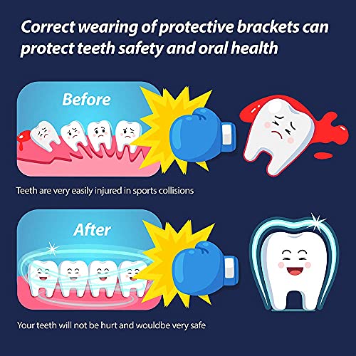 Youth Mouth Guard Football Sport Mouthguard, Premium Quality No Boiling Required，Suitable for Basketball, Wrestling, Taekwondo, Jujitsu and Karate - color: Blue1