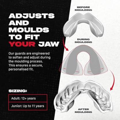 SAFEJAWZ Mouth Guard, Slim Fit Mouthguard for Adult & Youth with Case - color: White, size: Adult (12+ Years)