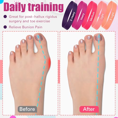 WinnerWhy 5 Pack Toe Exercise Bands Stretcher Separator Spacer,Pink - color: Pink