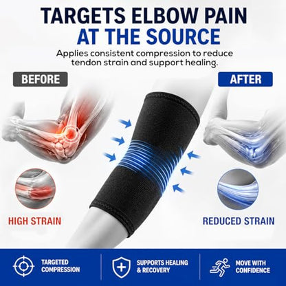 SB SOX Elbow Brace Compression Sleeve for Men & Women - color: Solid - Black, size: Small