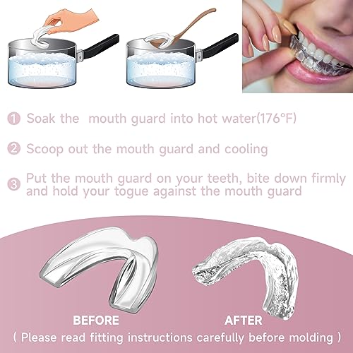 Pink Mouth Guard for Women, 4 Pack Medium Size