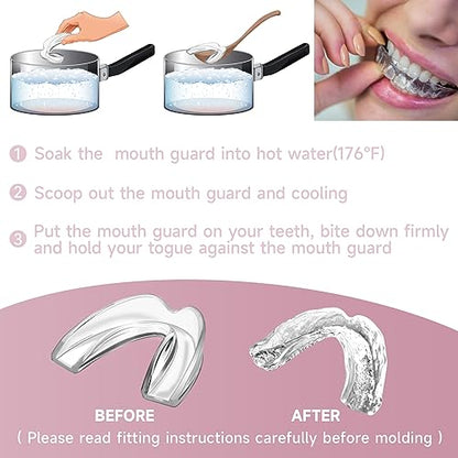 Pink Mouth Guard for Women, 4 Pack Medium Size