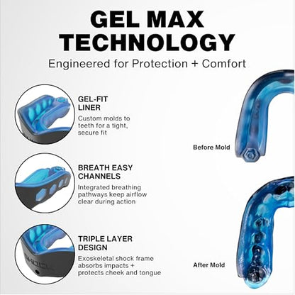 Shock Doctor Gel Max Power Carbon Convertible Mouth Guard - color: Carbon, size: Youth