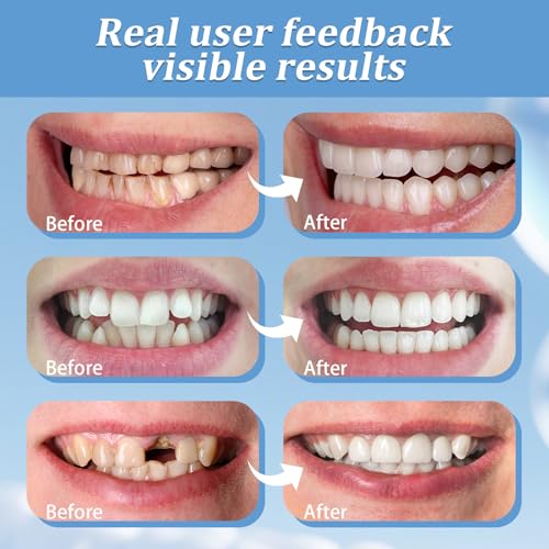 2 Pairs,Comfortable Smile,Smile that Temporarily restores Confidence,Top and Bottom (1)
