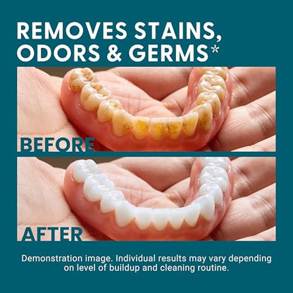 Denture Bath Case for Retainers, Phthalate-Free, No-Spill Strainer by M3 | 1 Case & Strainer for Invisalign Retainers, Baby Pacifiers, Mouth, Night & Snore Guards, Portable Soaking & Easy Rinsing - size: 1 Count (Pack of 1)