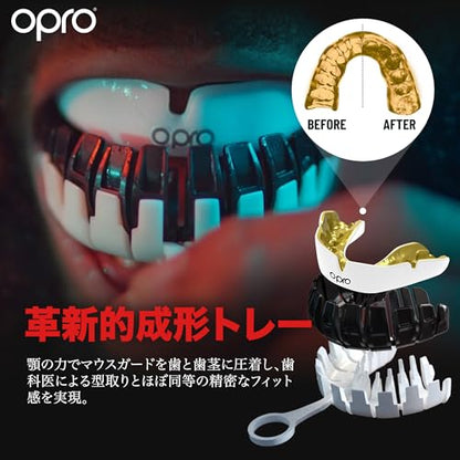 OPRO Instant Custom-Fit Mouthguard – Dentist Level Gum Shield Adult and Kids – OPRO Mouth Guard Boxing and MMA, Self-Fit Gum Shield Rugby – Maximum Protection with Dental Warranty (Black/White) - color: Black/White, size: Youth (Under 10)