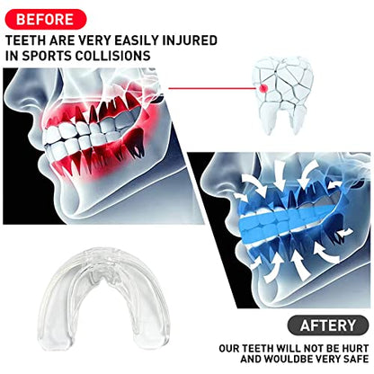3 Pack Kids Youth Mouth Guard Football Sports Braces Mouthguards for Mouthpiece Boys Teeth for MMA Boxing Rugby Kickboxing Taekwondo Softball Lacrosse to Braces EVA Transparent - color: Transparent
