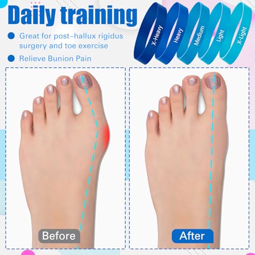 WinnerWhy 5 Pack Toe Exercise Bands Stretcher Separator Spacer,Blue - color: Blue