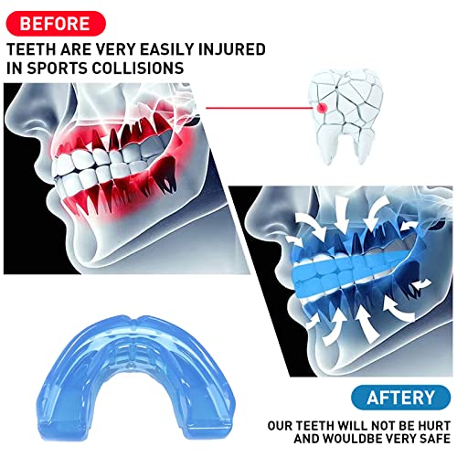 3 Pack Kids Youth Mouth Guard Football Sports Braces Mouthguards for Mouthpiece Boys Teeth for MMA Boxing Rugby Kickboxing Taekwondo Softball Lacrosse to Braces EVA Transparent Blue - color: Blue