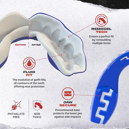 SAFEJAWZ Shark Mouth Guard, Adult Dual Layer Mouthguard with Case - color: Shark, size: Adult (12+)