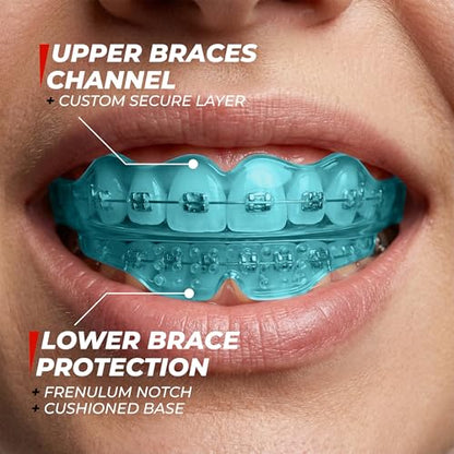 Mouth Guard for Braces - Kids Ages 7-10, Upper & Lower, No-Boil - color: Blue, size: Youth UpTo 10 Year