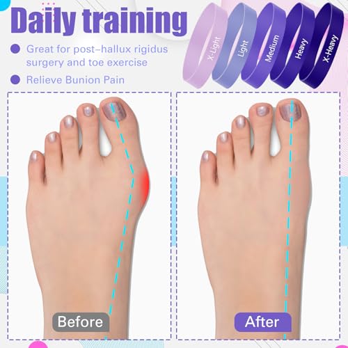 WinnerWhy 5 Pack Toe Exercise Bands Stretcher Separator Spacer,Purple - color: Purple